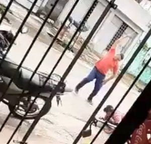 Brutally Hacked in Broad Daylight 