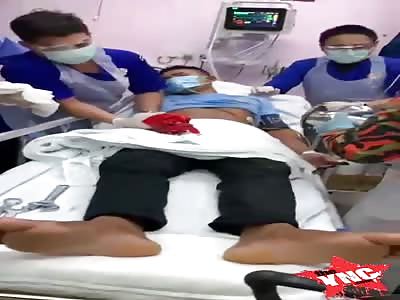 Friend, you shouldn't have put your hand in the meat grinder