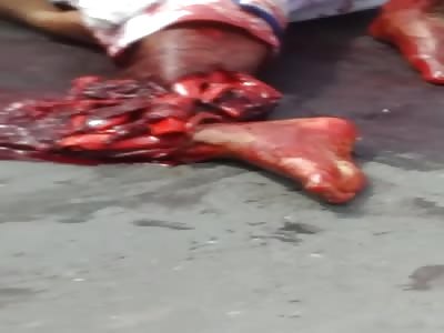 victim of serious  accident