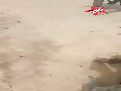 Legs of civilians destroyed