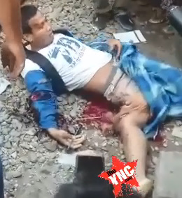 OMG! How Da Fuck He Is Still Alive ?!