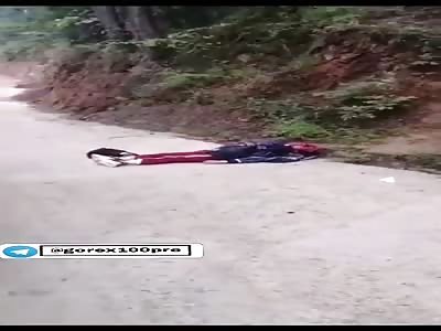 Boy with a totally destroyed face