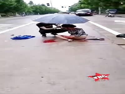 Ouch, friend your leg