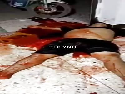 Man in his last moments of life