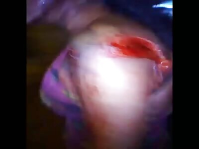 Ouch that must have hurt