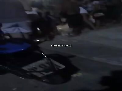 This is how it ended after a pitbull dog attack