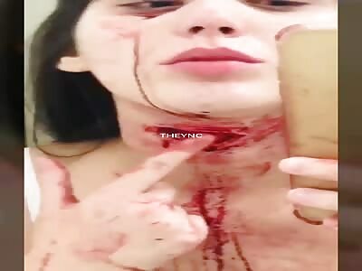 Girl tried to commit suicide