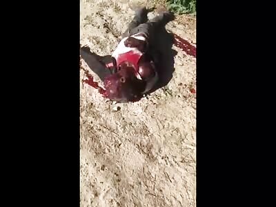 Man with his face shot down