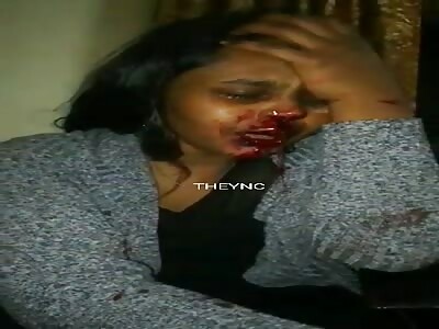 Woman after a beating