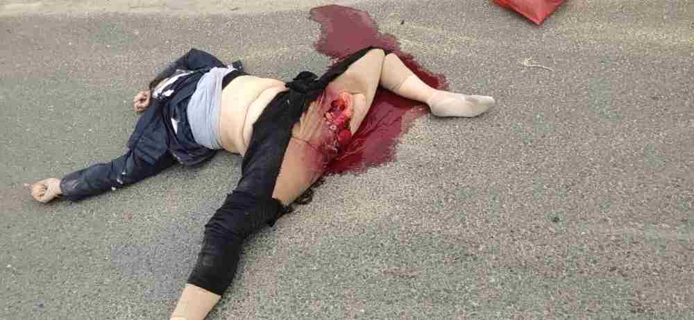 Victims of serious vehicle accident