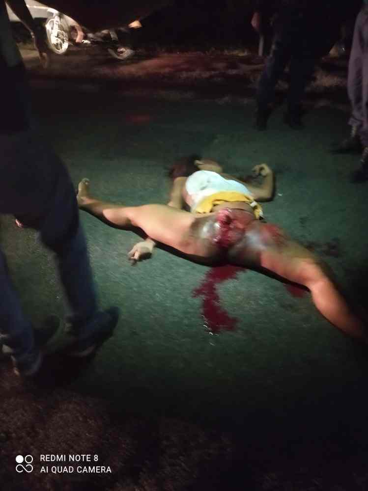 serious vehicle accident