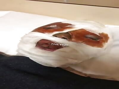 Russian pilot burned