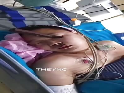 Young man with knife embedded in his face