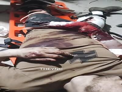 Young man injured after bombing