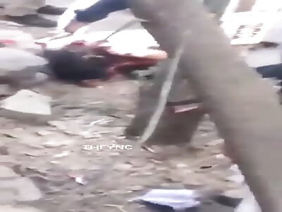 A woman in her last moments of life