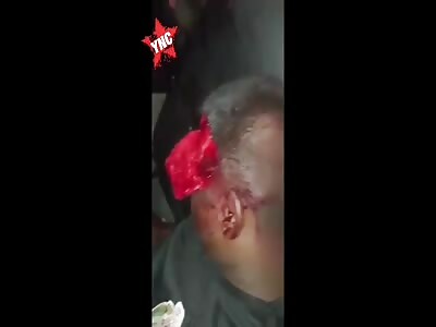 Police seriously injured after ramming parked car