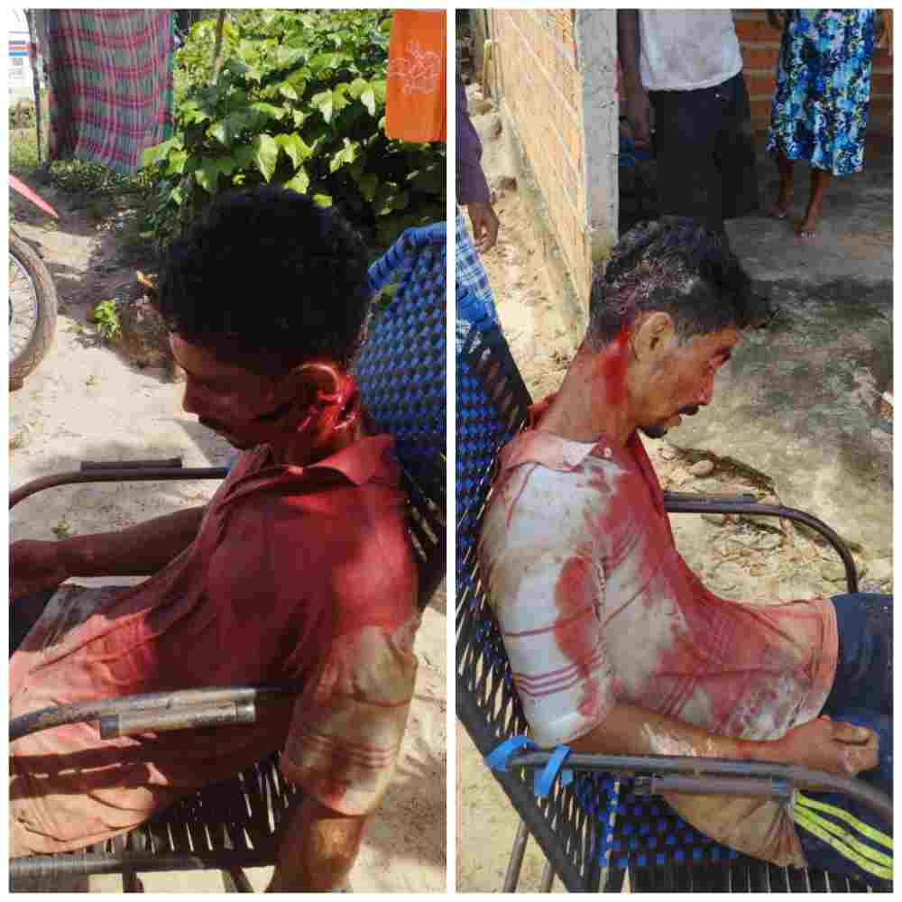 How Some Countries Take Care of Rapists