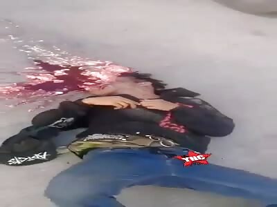 head crushed by truck