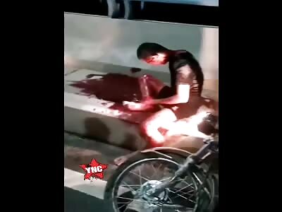 Man injured after motorcycle accident