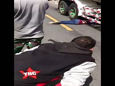 Victims of serious accidents