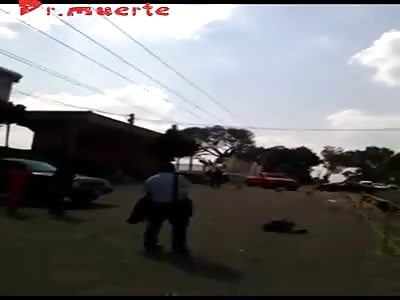 Injured by motorcycle accident