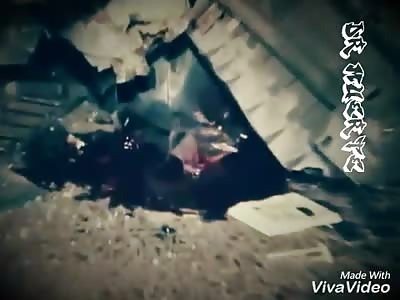 Man loses leg in accident