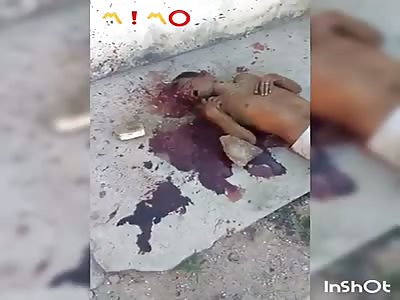 They throw rock at the head