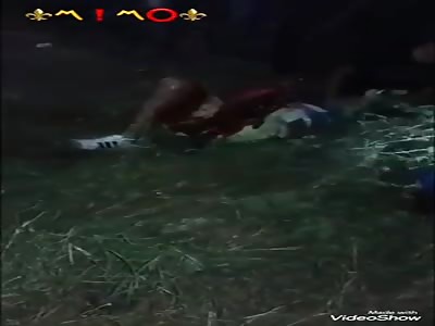 Loses his leg in motorcycle accident  (Part 2)