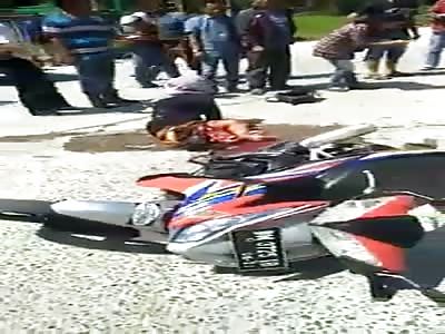 Longer version : woman with leg destroyed by motorcycle accident