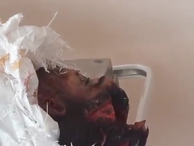 man with head crushed by a truck