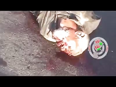 Motorcycle rider hit by road