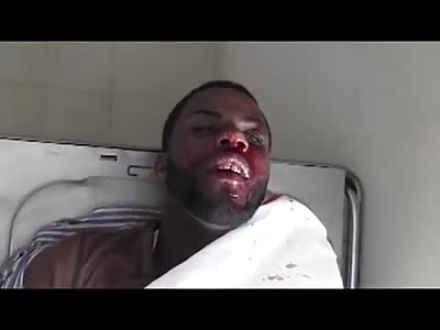 Tragic traffic accident leaves two dead people traveling by motorcycle