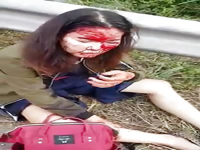 Bus accident leaves several injured