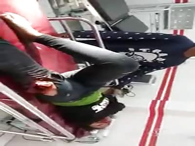 Woman with exposed femur