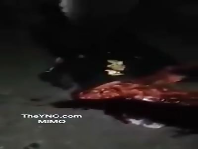 tragedy! the woman is left with the visors exposed, her body was destroyed after the accident