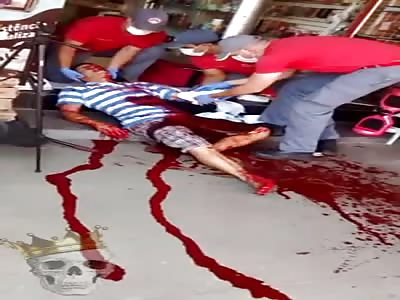 the man lost a lot of blood because of his destroyed hand! WTF