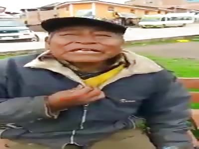 the old man has gangrenous leg