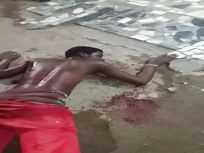 the man is dying! He has a shot in the back ... Brazil