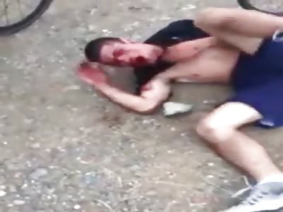 Thief hit by cyclists