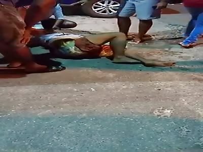 The boy in the accident had a broken arm and leg.