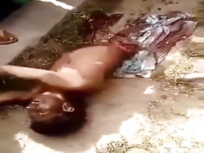 Boy cut in Half by Train (Still Alive) 