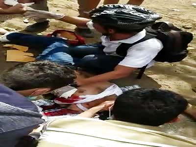 Protestor Shot in Nicaragua