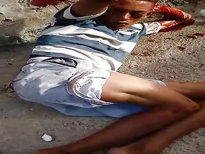 Motorcycle Thief dislocates femur