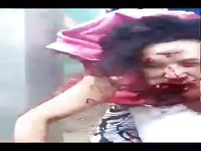 Man gets his jaw split from a gunshot