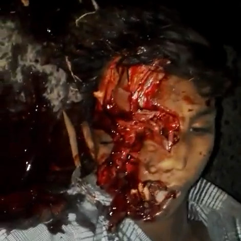 Ready for the Disguises Party After Accident 