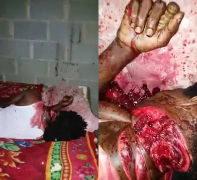 Haitian Man Killed with Machete