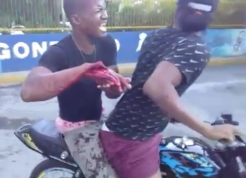 Man with Hand Almost Cut Off Is Brought to Hospital on Motorcycle