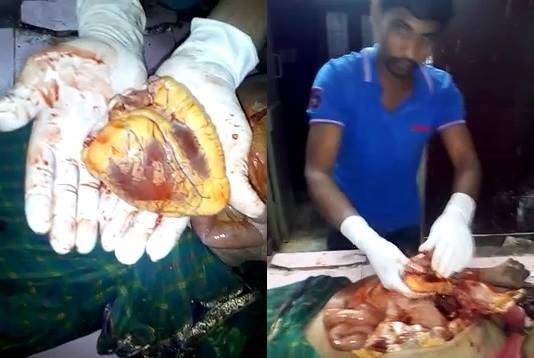 Autopsy Old woman in India