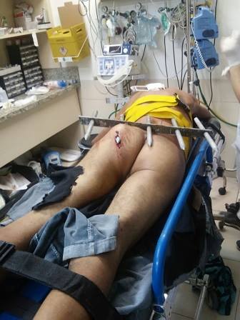 Thief impaled on the ass when trying to enter a house to steal