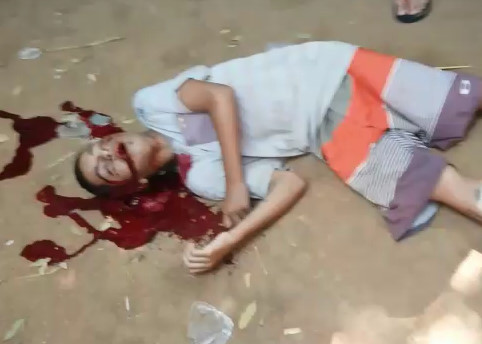 Final Gasping Blood Gurgling Moments After Being Shot in the Head 